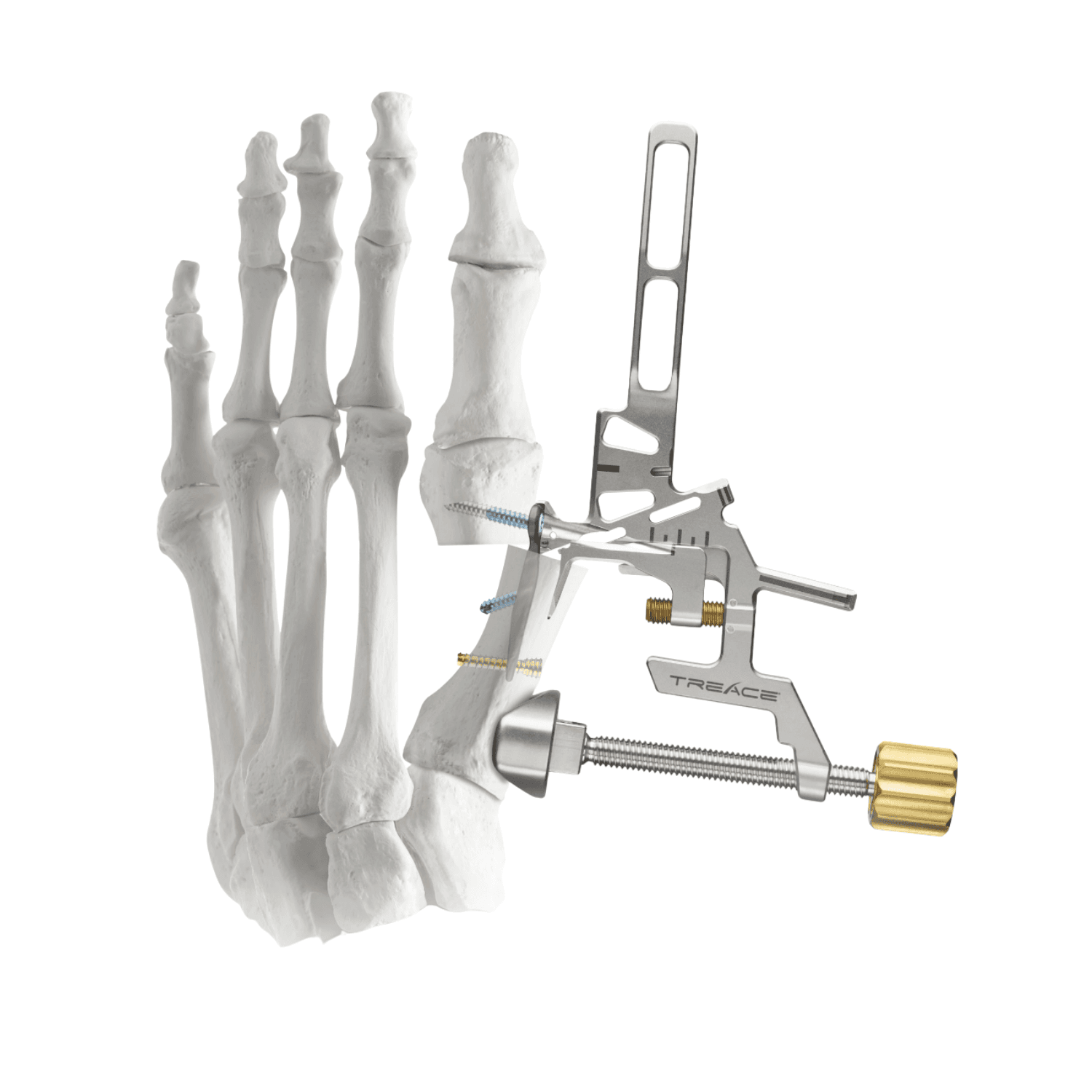 Image of Nanoplasty 1