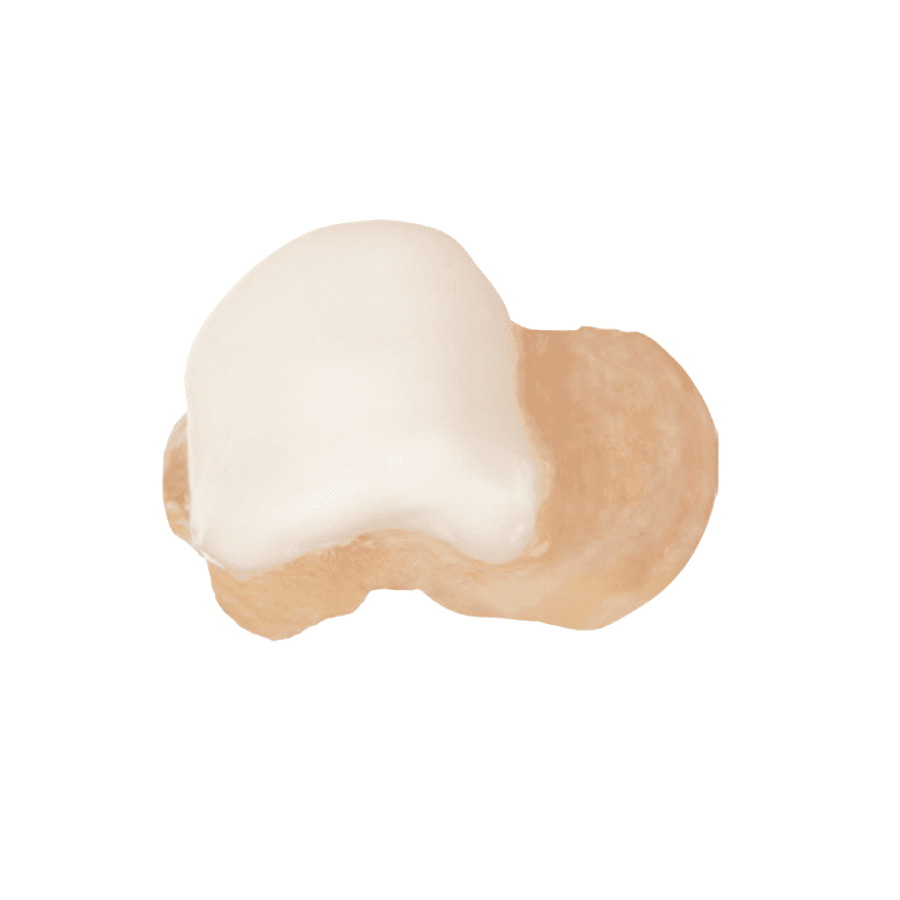 Image of Allograft Talus - Mops 1